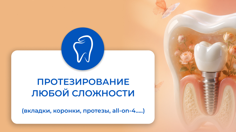 Протезирование Любой Сложности