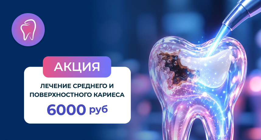 Акция! Лечение Кариеса поверхностного и среднего 6000 рублей