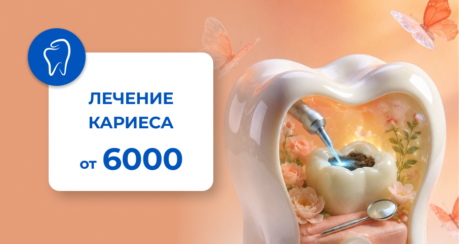 &nbsp;Лечение&nbsp; &nbsp;Кариеса поверхностного и среднего от 6000 рублей