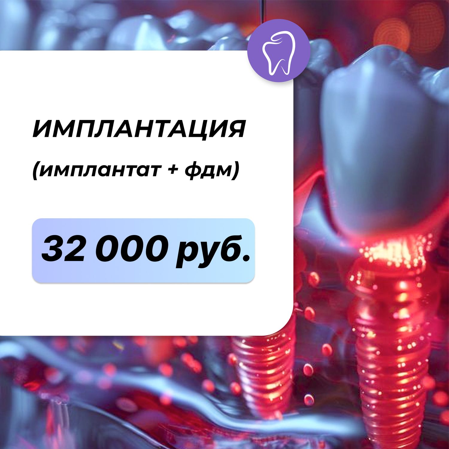 <span style="font-weight: bold;">Хирургия&nbsp; &nbsp; Имплантация (имплантат + ФДМ) - 32000 рублей</span>