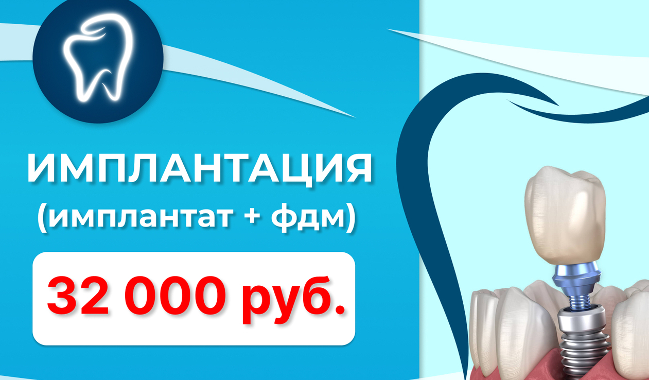<span style="font-weight: bold;">Хирургия&nbsp; &nbsp; Имплантация (имплантат + ФДМ) - 32000 рублей</span>